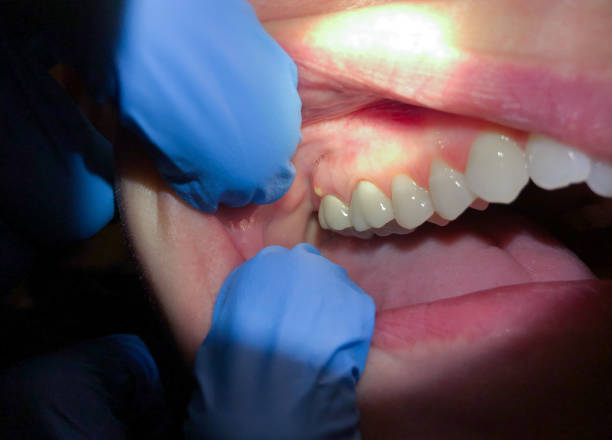 Best 24-Hour Emergency Dental Care in Kings Bay Base, GA
